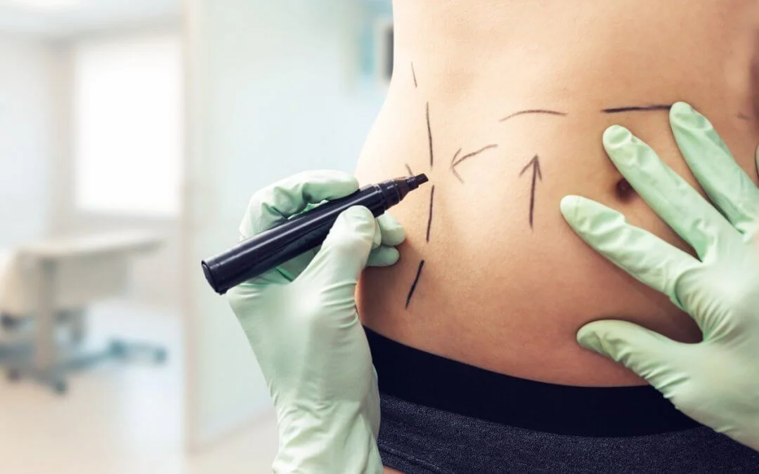 Clínicas de Cirurgia Plástica em Balneário Camboriú
